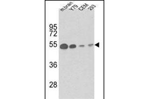 Western Blotting (WB) image for anti-Tubulin, beta 1 (TUBB1) antibody (ABIN658975)