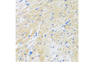 Immunohistochemistry (IHC) image for anti-BCL2-Associated Athanogene 3 (BAG3) (AA 380-575) antibody (ABIN7265851)