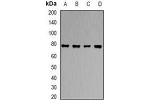 Western blot analysis of RBAT expression in HT29 (A), HepG2 (B), PC12 (C), mouse liver (D) whole cell lysates. (SLC3A1 抗体)