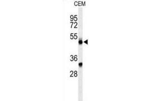 Western Blotting (WB) image for anti-Complement Factor P (CFP) antibody (ABIN3004386) (CFP 抗体)