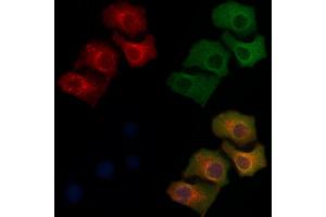 ABIN6259581 and ABIN6275562 staining Hela cells by IF/ICC. (SH2D5 抗体  (C-Term))