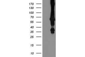 Western Blotting (WB) image for anti-Mahogunin, Ring Finger 1 (MGRN1) antibody (ABIN1499460) (Mahogunin RING Finger Protein 1 抗体)