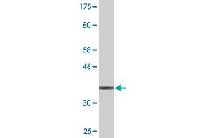 Western Blot detection against Immunogen (38. (S100A9 抗体  (AA 1-114))