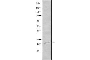 Western blot analysis of TRAPPC5 using HuvEc whole cell lysates (TRAPPC5 抗体  (Internal Region))