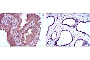 Immunohistochemistry (IHC) image for anti-Methylenetetrahydrofolate Reductase (NAD(P)H) (MTHFR) antibody (ABIN969297)