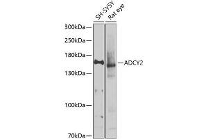 Western blot analysis of extracts of various cell lines, using  antibody (ABIN6129185, ABIN6136559, ABIN6136560 and ABIN6225105) at 1:1000 dilution. (ADCY2 抗体  (AA 430-600))