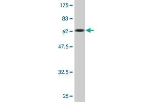 Western Blot detection against Immunogen (64. (NFKBIB 抗体  (AA 1-356))