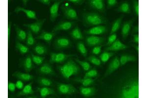 Immunofluorescence analysis of A549 cells using RAD17 antibody. (RAD17 抗体  (AA 391-670))