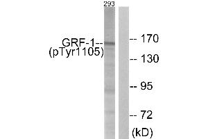 Immunohistochemistry analysis of paraffin-embedded human brain tissue using GRF-1 (Phospho-Tyr1105) antibody. (GRLF1 抗体  (pTyr1105))