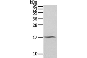 Gel: 12 % SDS-PAGE, Lysate: 40 μg, Lane: Human normal kidney tissue, Primary antibody: ABIN7193094(ZFAND2A Antibody) at dilution 1/300 dilution, Secondary antibody: Goat anti rabbit IgG at 1/8000 dilution, Exposure time: 2 minutes (ZFAND2A 抗体)