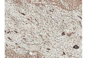 Immunohistochemistry analysis using Rabbit Anti-LRP1 Polyclonal Antibody (ABIN5696032). (LRP1 抗体  (AA 160-260) (APC))