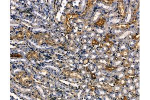 ABIN6265124 and ABIN6279850 at 1/100 staining mouse kidney tissue by IHC-P.