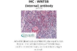 Image no. 1 for anti-Wingless-Type MMTV Integration Site Family, Member 5B (WNT5B) (Internal Region) antibody (ABIN1740832) (WNT5B 抗体  (Internal Region))