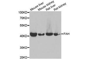 Western blot analysis of extracts of various cell lines, using FAH antibody. (FAH 抗体  (AA 1-419))