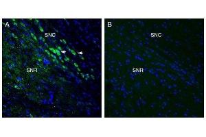 Expression of MCU in mouse midbrain. (MCU 抗体  (Mitochondrial Matrix))