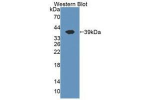 Western blot analysis of the recombinant protein. (CISH 抗体  (AA 1-258))