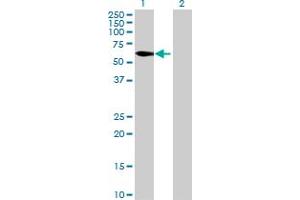 Western Blot analysis of C8orf45 expression in transfected 293T cell line by C8orf45 MaxPab polyclonal antibody. (C8orf45 抗体  (AA 1-585))