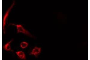 ABIN6275450 staining HeLa cells by IF/ICC. (RASA3 抗体  (Internal Region))