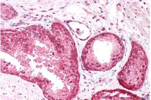 Immunohistochemistry (IHC) image for anti-Protein Interacting With Protein Kinase C, alpha 1 (PICK1) (Internal Region) antibody (ABIN185725)