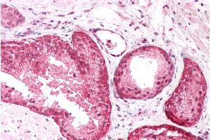 ABIN185725 (5µg/ml) staining of paraffin embedded Human Prostate. (PICK1 抗体  (Internal Region))