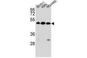 KREMEN2 Antibody (Center) western blot analysis in ZR-75-1,K562,NCI-H460 cell line lysates (35µg/lane). (KREMEN2 抗体  (Middle Region))