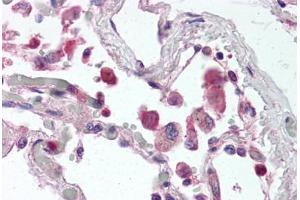 Human Lung (formalin-fixed, paraffin-embedded) stained with TLR9 antibody ABIN337069 at 5 ug/ml followed by biotinylated anti-mouse IgG secondary antibody ABIN481714, alkaline phosphatase-streptavidin and chromogen. (TLR9 抗体  (AA 268-284))