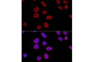 anti-X-Ray Repair Complementing Defective Repair in Chinese Hamster Cells 6 (XRCC6) (AA 408-609) antibody