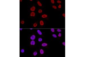 Confocal immunofluorescence analysis of U2OS cells using Ku70 Polyclonal Antibody (ABIN6134460, ABIN6150312, ABIN6150313 and ABIN6223171) at dilution of 1:100. (XRCC6 抗体  (AA 408-609))
