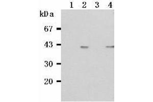Western Blotting (WB) image for anti-Tumor Necrosis Factor Receptor Superfamily, Member 13C (TNFRSF13C) antibody (ABIN1449226) (TNFRSF13C 抗体)
