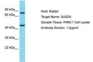 Image no. 1 for anti-Sushi Domain Containing 5 (SUSD5) (AA 304-353) antibody (ABIN6750594) (SUSD5 抗体  (AA 304-353))