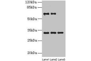 Western blot All lanes: OTX2 antibody at 4 μg/mL Lane 1: Jurkat whole cell lysate Lane 2: Hela whole cell lysate Lane 3: Mouse lung tissue Secondary Goat polyclonal to rabbit IgG at 1/10000 dilution Predicted band size: 32, 33 kDa Observed band size: 32 kDa (OTX2 抗体  (AA 1-297))