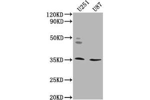 Western Blot Positive WB detected in: U251 whole cell lysate, U87 whole cell lysate All lanes: OR5K2 antibody at 1:2000 Secondary Goat polyclonal to rabbit IgG at 1/50000 dilution Predicted band size: 36 kDa Observed band size: 36 kDa (OR5K2 抗体  (AA 6-24))