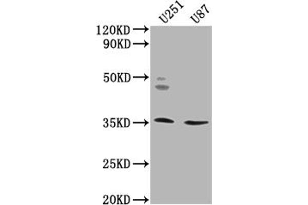 OR5K2 抗体  (AA 6-24)