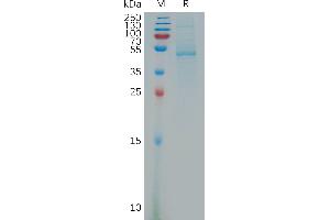SDS-PAGE (SDS) image for Platelet Derived Growth Factor D (PDGFD) (AA 250-370) protein (Fc Tag) (ABIN7491267)