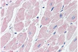 Human Heart (formalin-fixed, paraffin-embedded) stained with BAI3 antibody ABIN462085 followed by biotinylated goat anti-rabbit IgG secondary antibody ABIN481713, alkaline phosphatase-streptavidin and chromogen. (BAI3 抗体  (AA 1506-1522))