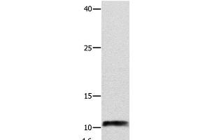 Western Blot analysis of Hela cell using NPY Polyclonal Antibody at dilution of 1:250 (NPY 抗体)