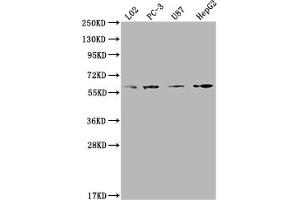 Western Blot Positive WB detected in: L02 whole cell lysate, PC-3 whole cell lysate, U87 whole cell lysate, HepG2 whole cell lysate All lanes: ICAM3 antibody at 1:2000 Secondary Goat polyclonal to rabbit IgG at 1/50000 dilution Predicted band size: 60 kDa Observed band size: 60 kDa (ICAM-3/CD50 抗体  (AA 200-547))