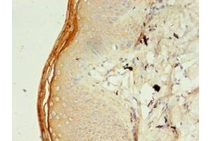 Immunohistochemistry of paraffin-embedded human skin tissue using ABIN7151288 at dilution of 1:100 (TRIM9 抗体  (AA 1-550))