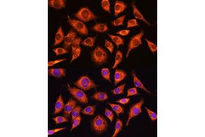 Immunofluorescence analysis of L929 cells using PPP1R15A Rabbit pAb (ABIN7269676) at dilution of 1:100. (GADD34 抗体  (AA 375-674))