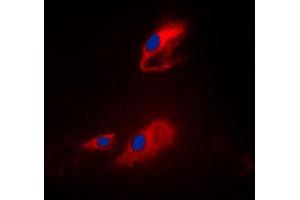 Immunofluorescent analysis of ACOT8 staining in Raji cells. (ACOT8 抗体  (Center))