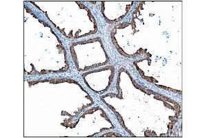 IHC analysis of AS160/TBC1D4 using anti-AS160/TBC1D4 antibody (ABIN7599745). (TBC1D4 抗体  (AA 1118-1298))