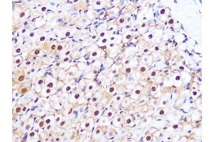 Immunohistochemistry of paraffin-embedded rat ovary using PSM Rabbit mAb (ABIN7269600) at dilution of 1:100 (40x lens). (PSMA3 抗体)