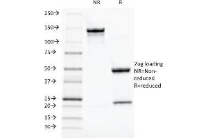 SDS-PAGE Analysis Purified TOX3 Mouse Monoclonal Antibody (TOX3/1124). (TOX3 抗体  (AA 251-389))