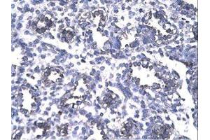 Image no. 1 for anti-Forkhead Box P1 (FOXP1) (AA 223-270) antibody (ABIN202867) (FOXP1 抗体  (AA 223-270))