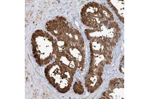 Immunohistochemical staining of human liver with TGM4 polyclonal antibody  shows strong cytoplasmic positivity in glandular cells. (TGM4 抗体)