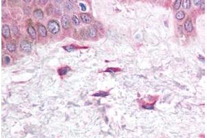 Human Skin, Fibroblasts (formalin-fixed, paraffin-embedded) stained with CXCL12 antibody ABIN214748 at 5 ug/ml followed by biotinylated goat anti-rabbit IgG secondary antibody ABIN481713, alkaline phosphatase-streptavidin and chromogen. (CXCL12 抗体  (C-Term))