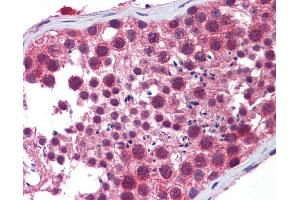 Immunohistochemistry (IHC) image for anti-Histone Deacetylase 6 (HDAC6) (N-Term) antibody (ABIN616900) (HDAC6 抗体  (N-Term))