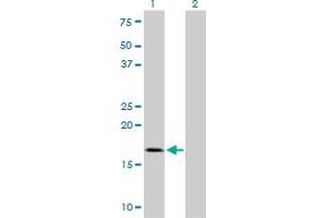 Western Blot analysis of TOMM22 expression in transfected 293T cell line by TOMM22 monoclonal antibody (M01), clone 4G4. (TOMM22 抗体  (AA 1-142))