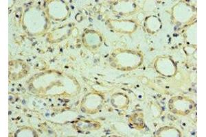 Immunohistochemistry of paraffin-embedded human kidney tissue using ABIN7175476 at dilution of 1:100 (VAMP3 抗体  (AA 1-80))