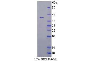 SDS-PAGE analysis of Rat VNN1 Protein. (VNN1 蛋白)